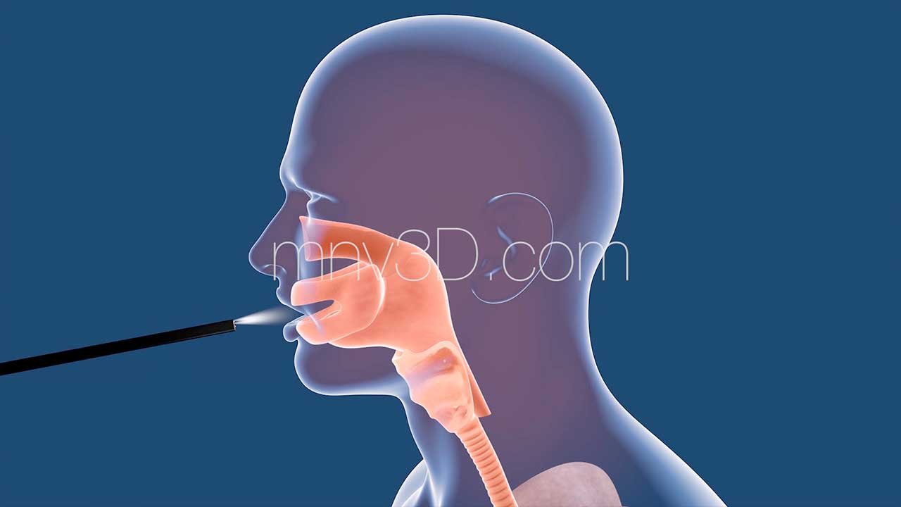 3D animation medical-design Animation 3D pour illustration medicale